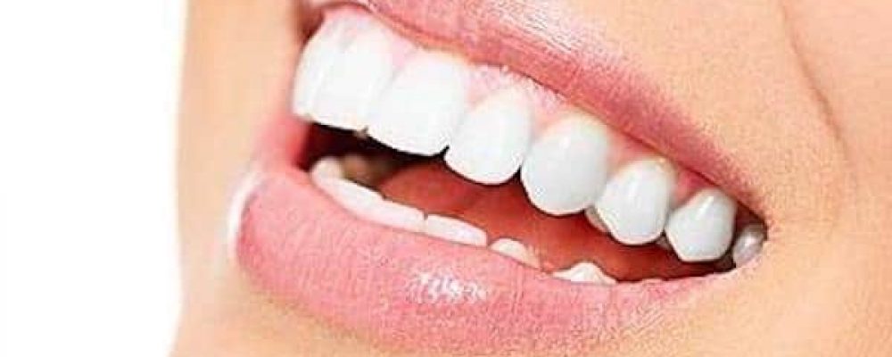 Christmas Special Teeth Whitening